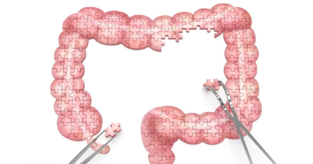 Kiedy odkryto raka? Historia, która zaskakuje i inspiruje